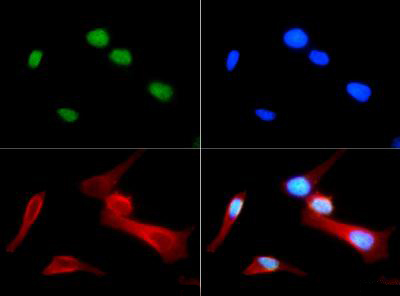 HIST4H4 Antibody - Immunofluorescence of rabbit Anti-Histone H4 [Monomethyl Arg3] Antibody. Tissue: Nonmitotic, prophase, and telophase HeLa cells. Fixation: 0.5% PFA. Antigen retrieval: Not required. Primary antibody: Histone H4 [Monomethyl Arg3] antibody at a 1:50 dilution for 1 h at RT. Secondary antibody: FITC secondary antibody at 1:10,000 for 45 min at RT. Localization: Histone H4 [Monomethyl Arg3] is nuclear and chromosomal. Staining: Histone H4 [Monomethyl Arg3] is expressed in green, nuclei are counterstained with DAPI (blue).