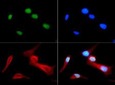 HIST4H4 Antibody - Immunofluorescence of rabbit Anti-Histone H4 [Monomethyl Arg3] Antibody. Tissue: Nonmitotic, prophase, and telophase HeLa cells. Fixation: 0.5% PFA. Antigen retrieval: Not required. Primary antibody: Histone H4 [Monomethyl Arg3] antibody at a 1:50 dilution for 1 h at RT. Secondary antibody: FITC secondary antibody at 1:10,000 for 45 min at RT. Localization: Histone H4 [Monomethyl Arg3] is nuclear and chromosomal. Staining: Histone H4 [Monomethyl Arg3] is expressed in green, nuclei are counterstained with DAPI (blue).