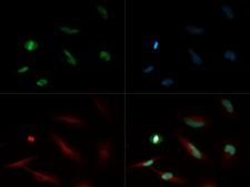 HIST4H4 Antibody - Immunofluorescence of rabbit Anti-Histone H4 [Monomethyl Lys20] Antibody. Tissue: HeLa cells. Fixation: 0.5% PFA. Antigen retrieval: Not required. Primary antibody: Histone H4 [Monomethyl Lys20] antibody at a 1:500 dilution for 1 h at RT. Secondary antibody: FITC secondary antibody at 1:10,000 for 45 min at RT. Localization: Histone H4 [Monomethyl Lys20] is nuclear and chromosomal. Staining: Histone H4 [Monomethyl Lys20] is expressed in green, nuclei and alpha-tubulin are counterstained with DAPI (blue) and Dylight 550 (red).