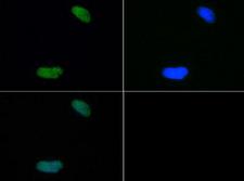 HIST4H4 Antibody - Immunofluorescence of rabbit Anti-Histone H4 [Dimethyl Lys20] Antibody. Tissue: HeLa cells. Fixation: 0.5% PFA. Antigen retrieval: Not required. Primary antibody: Histone H4 [Dimethyl Lys20] antibody at a 1:50 dilution for 1 h at RT. Secondary antibody: FITC secondary antibody at 1:10,000 for 45 min at RT. Localization: Histone H4 [Dimethyl Lys20] is nuclear and chromosomal. Staining: Histone H4 [Dimethyl Lys20] is expressed in green, nuclei are counterstained with DAPI (blue).