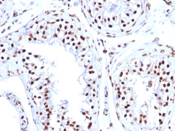 Histone Antibody - FFPE human testicular carcinoma tested with Histone H1 antibody (1415-1).  This image was taken for the unmodified form of this product. Other forms have not been tested.