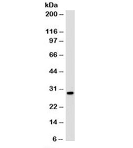 Histone Antibody - Western blot testing of HeLa cell lysate (nuclear fraction) with Histone antibody (clone 1415-1). Observed molecular weight ~22/30-33kDa (unmodified/modified).