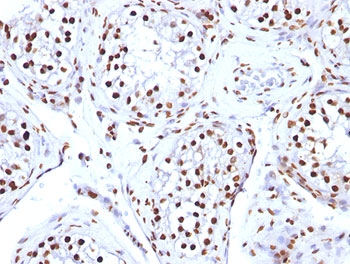 Histone Antibody - FFPE human testicular carcinoma tested with Histone antibody (AE-4).  This image was taken for the unmodified form of this product. Other forms have not been tested.
