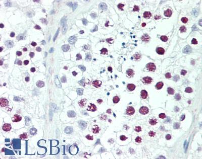 Histone Antibody - Human Testis: Formalin-Fixed, Paraffin-Embedded (FFPE)