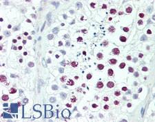 Histone Antibody - Human Testis: Formalin-Fixed, Paraffin-Embedded (FFPE)