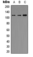 Histone Deacetylase HDAC5 / HDAC9 Antibody - Western blot analysis of Histone Deacetylase 5/9 expression in HeLa (A); NIH3T3 (B); rat intestine (C) whole cell lysates.