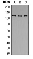 Histone Deacetylase HDAC5 / HDAC9 Antibody - Western blot analysis of Histone Deacetylase 5/9 (pS259/220) expression in PC3 (A); HeLa (B); NIH3T3 (C) whole cell lysates.
