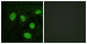 Histone H1 Antibody - Immunofluorescence of HeLa cells, using Histone H1 (Ab-25) Antibody. The picture on the right is treated with the synthesized peptide.