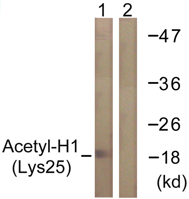 Histone H1 Antibody - Western blot analysis of lysates from COS7 cells, treated with TSA 400nM 24h, using Histone H1 (Acetyl-Lys25) Antibody. The lane on the right is blocked with the synthesized peptide.