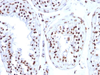Histone H1 Antibody - FFPE human testicular carcinoma tested with Histone H1 antibody (HH1/957).  This image was taken for the unmodified form of this product. Other forms have not been tested.