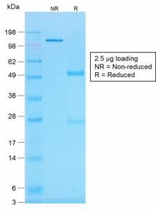 Histone H1 Antibody - SDS-PAGE Analysis Purified Histone H1 Mouse Recombinant Monoclonal Antibody (r1415-1). Confirmation of Purity and Integrity of Antibody.