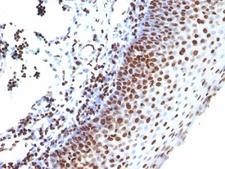 Histone H1 Antibody - Formalin-fixed, paraffin-embedded human tonsil stained with anti-Histone H1 antibody (SPM256).  This image was taken for the unmodified form of this product. Other forms have not been tested.