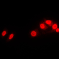 Histone H1 Antibody - Immunofluorescent analysis of Histone H1 staining in Raw264.7 cells. Formalin-fixed cells were permeabilized with 0.1% Triton X-100 in TBS for 5-10 minutes and blocked with 3% BSA-PBS for 30 minutes at room temperature. Cells were probed with the primary antibody in 3% BSA-PBS and incubated overnight at 4 C in a humidified chamber. Cells were washed with PBST and incubated with a DyLight 594-conjugated secondary antibody (red) in PBS at room temperature in the dark. DAPI was used to stain the cell nuclei (blue).