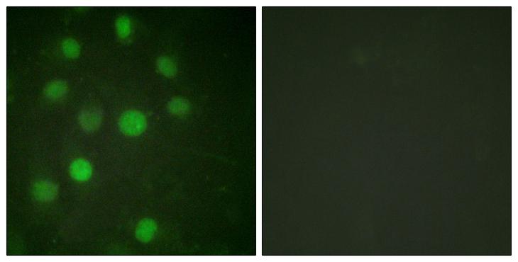 Histone H1 Antibody - serum + - Immunofluorescence analysis of HuvEc cells, treated with serum (20%, 15mins), using Histone H1 (Ab-17) antibody.