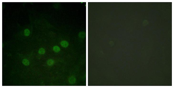 Histone H1 Antibody - Immunofluorescence analysis of HUVEC cells treated with serum 20% 30', using Histone H1 (Phospho-Thr17) Antibody. The picture on the right is blocked with the phospho peptide.