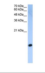 Histone H2A Antibody - Jurkat cell lysate. Antibody concentration: 2.5 ug/ml. Gel concentration: 15%.  This image was taken for the unconjugated form of this product. Other forms have not been tested.