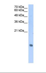 Histone H2A Antibody - Jurkat cell lysate. Antibody concentration: 2.5 ug/ml. Gel concentration: 15%.  This image was taken for the unconjugated form of this product. Other forms have not been tested.
