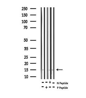 Histone H2A Antibody - Western blot analysis of Phospho-Histone H2A (Thr121) expression in various lysates