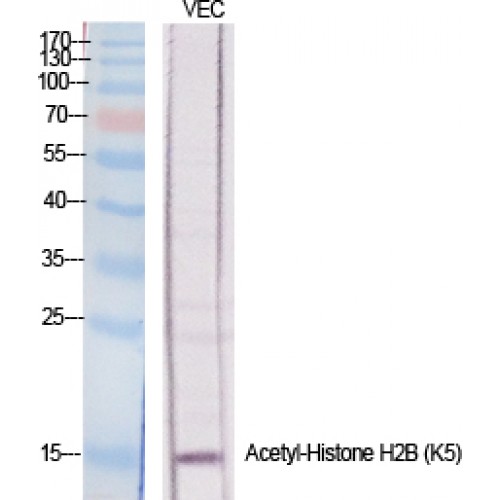 Histone H2B Antibody - Western blot of Acetyl-Histone H2B (K5) antibody