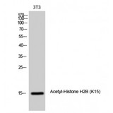Histone H2B Antibody - Western blot of Acetyl-Histone H2B (K15) antibody