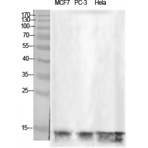 Histone H2B Antibody - Western blot of Histone H2B antibody