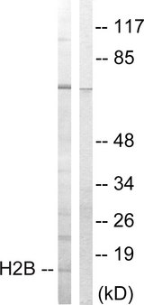 Histone H2B Antibody - Western blot analysis of lysates from Jurkat cells, treated with UV 15', using Histone H2B Antibody. The lane on the right is blocked with the synthesized peptide.