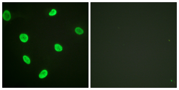Histone H2B Antibody - Immunofluorescence analysis of HeLa cells, using Histone H2B (Acetyl-Lys12) Antibody. The picture on the right is blocked with the synthesized peptide.