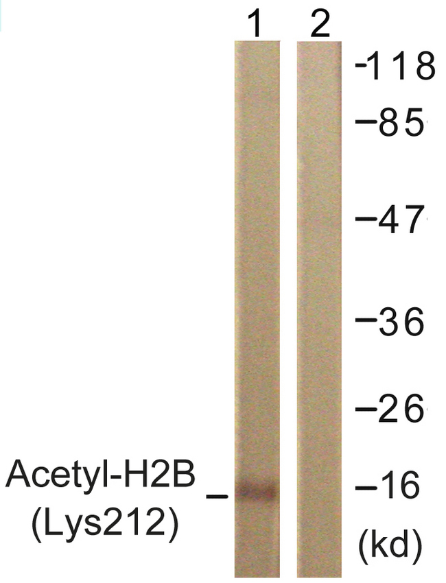 Histone H2B Antibody - Western blot analysis of lysates from COS7 cells, treated with TSA 400nM 24h, using Histone H2B (Acetyl-Lys12) Antibody. The lane on the right is blocked with the synthesized peptide.