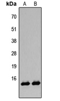 Histone H2B Antibody - Western blot analysis of Histone H2B (AcK12) expression in A431 TSA-treated (A); HeLa TSA-treated (B) whole cell lysates.