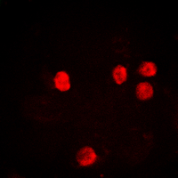 Histone H2B Antibody - Immunofluorescent analysis of Histone H2B (AcK12) staining in HeLa cells. Formalin-fixed cells were permeabilized with 0.1% Triton X-100 in TBS for 5-10 minutes and blocked with 3% BSA-PBS for 30 minutes at room temperature. Cells were probed with the primary antibody in 3% BSA-PBS and incubated overnight at 4 deg C in a humidified chamber. Cells were washed with PBST and incubated with a DyLight 594-conjugated secondary antibody (red) in PBS at room temperature in the dark. DAPI was used to stain the cell nuclei (blue).
