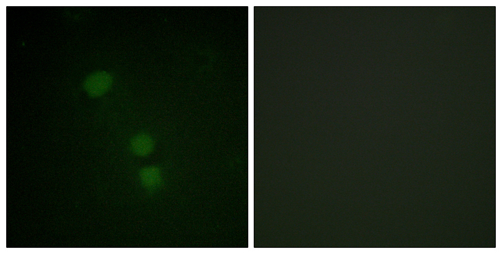 Histone H2B Antibody - Immunofluorescence analysis of HeLa cells, using Histone H2B (Acetyl-Lys15) Antibody. The picture on the right is blocked with the synthesized peptide.