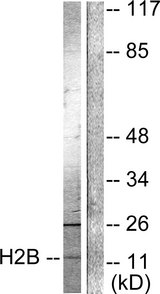 Histone H2B Antibody - Western blot analysis of lysates from Raw264.7 cells, treated with TSA 400nM 24h, using Histone H2B (Acetyl-Lys15) Antibody. The lane on the right is blocked with the synthesized peptide.