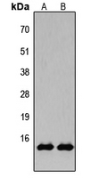 Histone H2B Antibody - Western blot analysis of Histone H2B (AcK15) expression in HeLa TSA-treated (A); NIH3T3 TSA-treated (B) whole cell lysates.