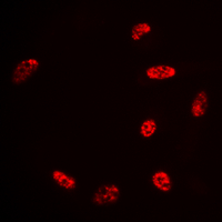 Histone H2B Antibody - Immunofluorescent analysis of Histone H2B (AcK15) staining in HeLa cells. Formalin-fixed cells were permeabilized with 0.1% Triton X-100 in TBS for 5-10 minutes and blocked with 3% BSA-PBS for 30 minutes at room temperature. Cells were probed with the primary antibody in 3% BSA-PBS and incubated overnight at 4 deg C in a humidified chamber. Cells were washed with PBST and incubated with a DyLight 594-conjugated secondary antibody (red) in PBS at room temperature in the dark. DAPI was used to stain the cell nuclei (blue).