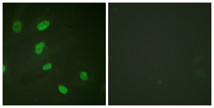 Histone H2B Antibody - Immunofluorescence analysis of HeLa cells, using Histone H2B (Acetyl-Lys5) Antibody. The picture on the right is blocked with the synthesized peptide.