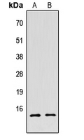 Histone H2B Antibody - Western blot analysis of Histone H2B (AcK5) expression in HEK293T TSA-treated (A); NIH3T3 TSA-treated (B) whole cell lysates.