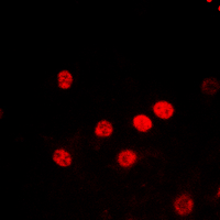 Histone H2B Antibody - Immunofluorescent analysis of Histone H2B (AcK5) staining in HEK293T cells. Formalin-fixed cells were permeabilized with 0.1% Triton X-100 in TBS for 5-10 minutes and blocked with 3% BSA-PBS for 30 minutes at room temperature. Cells were probed with the primary antibody in 3% BSA-PBS and incubated overnight at 4 deg C in a humidified chamber. Cells were washed with PBST and incubated with a DyLight 594-conjugated secondary antibody (red) in PBS at room temperature in the dark. DAPI was used to stain the cell nuclei (blue).