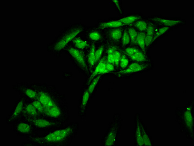 Histone H2B Antibody - Immunofluorescence staining of Hela cells with HIST1H2BC Antibody at 1:200, counter-stained with DAPI. The cells were fixed in 4% formaldehyde, permeabilized using 0.2% Triton X-100 and blocked in 10% normal Goat Serum. The cells were then incubated with the antibody overnight at 4°C. The secondary antibody was Alexa Fluor 488-congugated AffiniPure Goat Anti-Rabbit IgG(H+L).