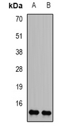 Histone H2B Antibody - Western blot analysis of Histone H2B expression in SW480 (A); BT474 (B) whole cell lysates.