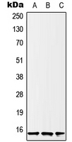 Histone H2B Antibody - Western blot analysis of Histone H2B expression in U2OS (A); HeLa (B); A431 (C) whole cell lysates.