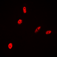 Histone H2B Antibody - Immunofluorescent analysis of Histone H2B staining in HeLa cells. Formalin-fixed cells were permeabilized with 0.1% Triton X-100 in TBS for 5-10 minutes and blocked with 3% BSA-PBS for 30 minutes at room temperature. Cells were probed with the primary antibody in 3% BSA-PBS and incubated overnight at 4 deg C in a humidified chamber. Cells were washed with PBST and incubated with a DyLight 594-conjugated secondary antibody (red) in PBS at room temperature in the dark. DAPI was used to stain the cell nuclei (blue).