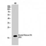 Histone H3 Antibody - Western blot of Acetyl-Histone H3 (K9) antibody