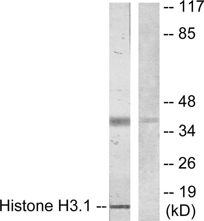 Histone H3 Antibody - Western blot analysis of lysates from COLO205 cells, using Histone H3.1 Antibody. The lane on the right is blocked with the synthesized peptide.