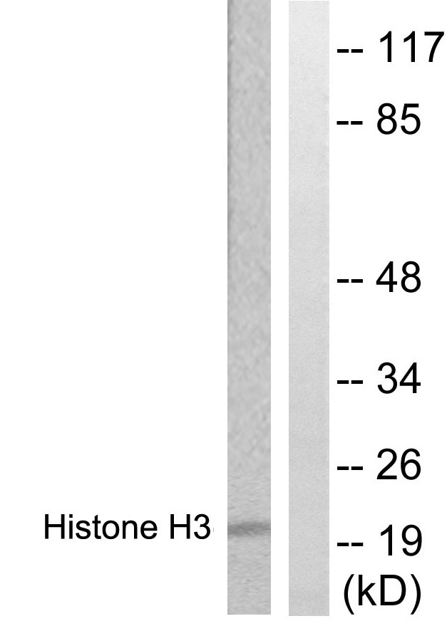 Histone H3 Antibody - Western blot analysis of lysates from HUVEC cells, treated with Serum 20% 30', using Histone H3 Antibody. The lane on the right is blocked with the synthesized peptide.