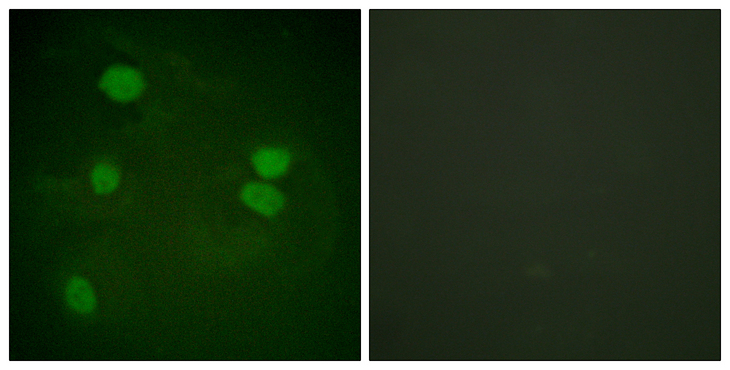 Histone H3 Antibody - Immunofluorescence analysis of HeLa cells, using Histone H3 Antibody. The picture on the right is blocked with the synthesized peptide.