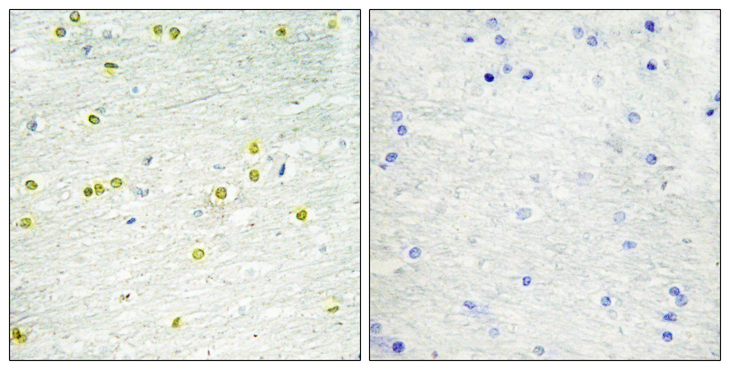 Histone H3 Antibody - Immunohistochemistry analysis of paraffin-embedded human brain tissue, using Histone H3 Antibody. The picture on the right is blocked with the synthesized peptide.