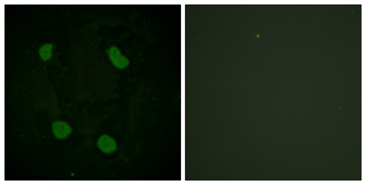 Histone H3 Antibody - Immunofluorescence analysis of HeLa cells, using Histone H3 (Acetyl-Lys14) Antibody. The picture on the right is blocked with the synthesized peptide.