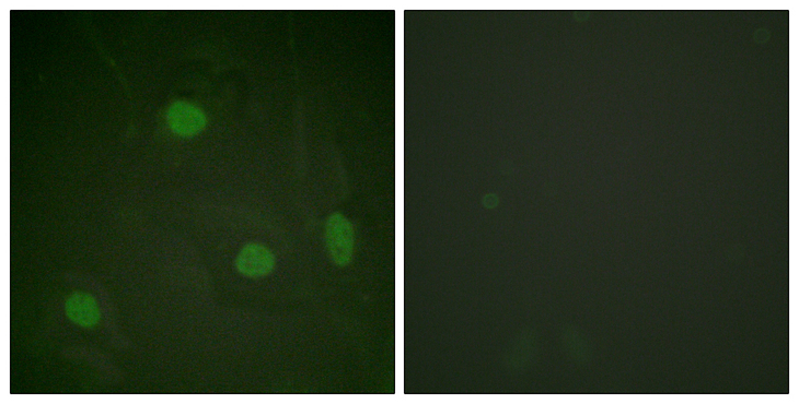 Histone H3 Antibody - Immunofluorescence analysis of HeLa cells, using Histone H3 (Acetyl-Lys23) Antibody. The picture on the right is blocked with the synthesized peptide.
