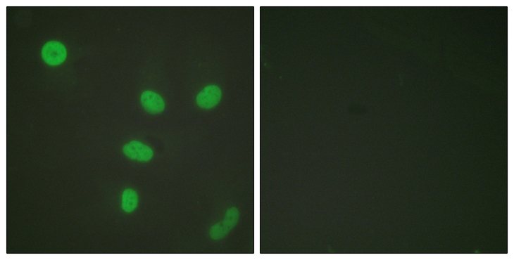 Histone H3 Antibody - Immunofluorescence analysis of HeLa cells, using Histone H3 (Acetyl-Lys27) Antibody. The picture on the right is blocked with the synthesized peptide.