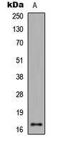 Histone H3 Antibody - Western blot analysis of Histone H3 (AcK27) expression in HeLa TSA-treated (A) whole cell lysates.